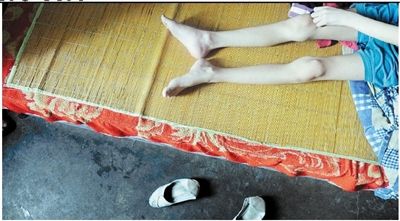 14-year-old Guo Guo who is as slim as a human skeleton