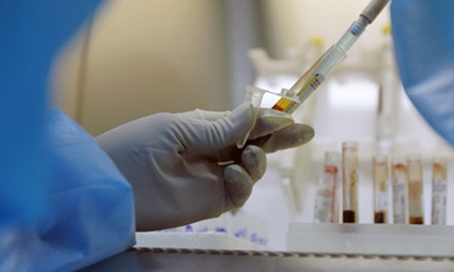 A senior health official on Wednesday advocated the use of real-name HIV testing, stating that the tests will be beneficial for the prevention and treatment of HIV/AIDS. Photo: Xinhua 