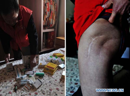 This combined photo taken on April 8, 2013 shows Fang Bo sorting his medicines he has to eat everyday (L) and a surgery scar on his leg. (Xinhua/Li Wen)