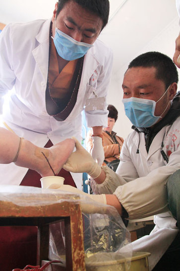Tibetan monk-doctor Ngawang Thayi (left), 39, checks blood that was let out forcibly from a patient suffering from swollen feet caused by varicose veins. Wang Huazhong / China Daily