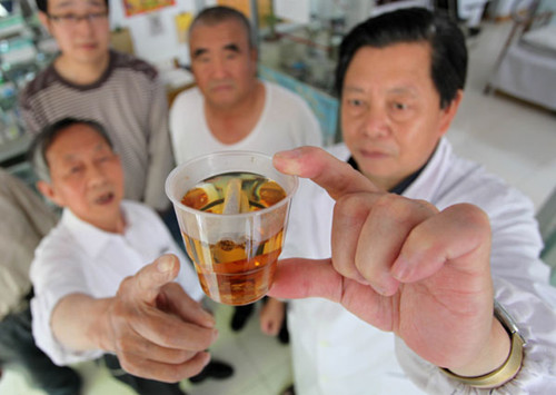 A community doctor explains to residents the harms of smoking by showing them nicotine dissolved in water in Weifang, Shandong province, on Thursday. ZHANG CHI / FOR CHINA DAILY