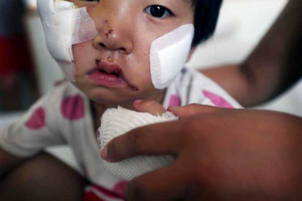 The father of Nannan, 5, says he doesn't have enough money to pay for his daughter's facial reconstruction surgery after she was attacked by a Tibetan mastiff on July 13 in Beijing. Hei Ke / for China Daily