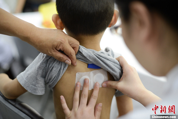 A doctor pastes plasters on the back of a child at a Beijing hospital on July 13, 2013. (CNS File Photo)