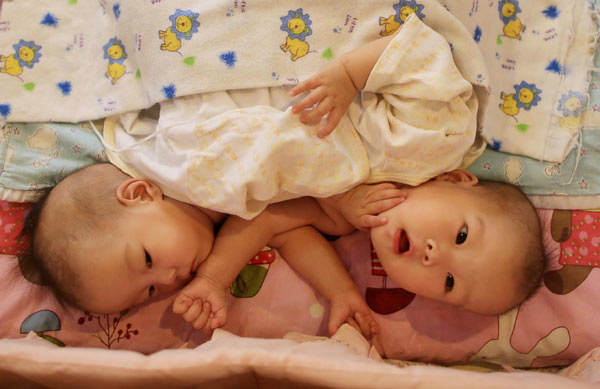 Conjoined twins Zheng Hanjing and Zheng Hanwei are being cared for at Angel's Home in Beijing's Changping district. Fu Ding / For China Daily