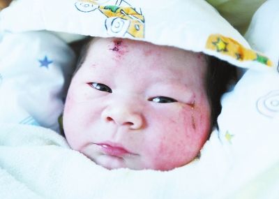 This undated photo shows a baby boy born during a road accident that killed his parents in the southeastern city of Xiamen. (Photo source: Xiamen Daily)