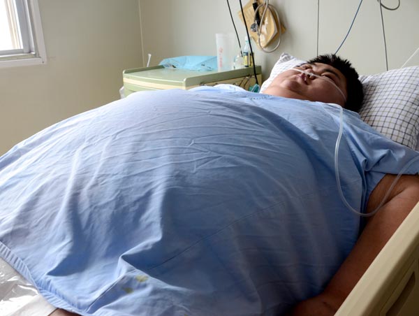 Sun Liang was hospitalized with complications from obesity in Rizhao, Shandong province, on April 14. He died on Sunday. WU RUICHAO / FOR CHINA DAILY