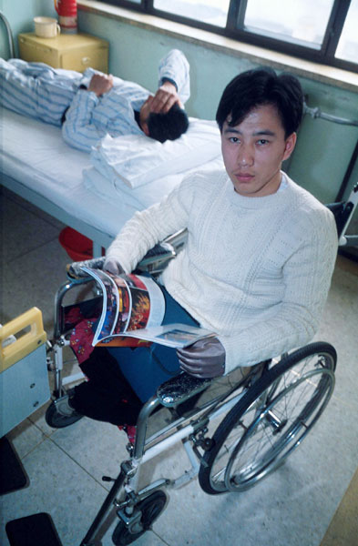 This 2001 photo shows Song Xuewen, who found a key chain-shaped source of ir-192 at a construction company in Jilin province in 1996, and later suffered from radiation sickness. Provided to China Daily 