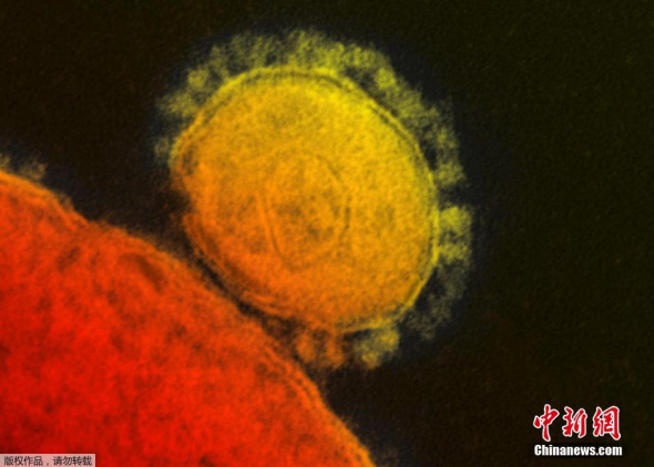 Photo shows the MERS virus. [Photo: Agencies]