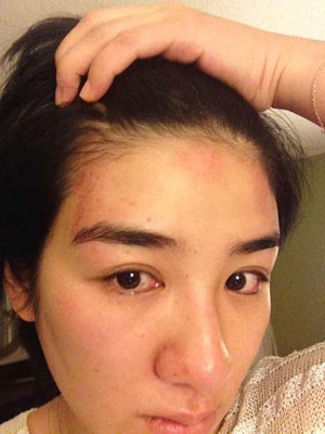 Chinese actress Huang Yi has taken to social media to show people injuries allegedly caused by her husband Huang Yiqing. [Photo/Xinhua] 