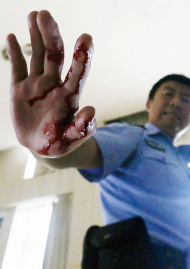 A police officer's right hand has been cut by the knife in the training, and is bleeding heavily. (Photo: People's Daily Online)