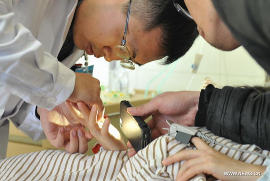 A doctor removes glass from a victim's hand who is injured of a bus fire at the No.1 Hospital in Xiamen,Southeast China's Fujian Province, Jan 15, 2015.[Xinhua]