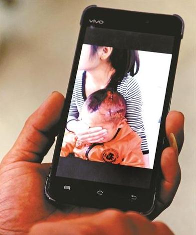 The boy's father shows his 3-year-old son's injuries on head with a photo.(Photo/Xinhua)