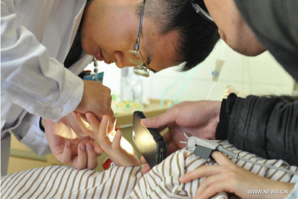 A doctor removes glass from a victim's hand who is injured of a bus fire at the No.1 Hospital in Xiamen, East China's Fujian province, Jan 15, 2015. (Photo/Xinhua)