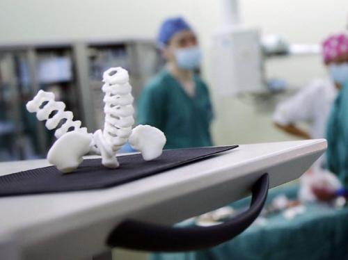 Their anatomy was modeled by 3-D printing technology. The model was used to guide surgeons in the operating room. (China Daily/Yin Liqin)