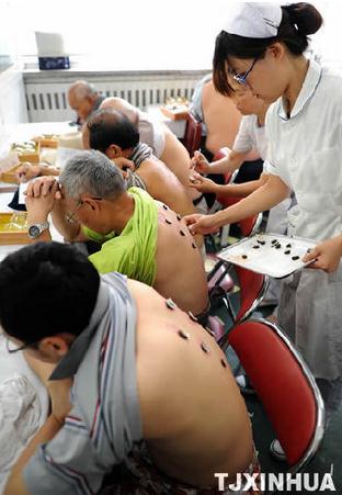 Patients are receiving the Sanfutie. (Photo/Xinhua)