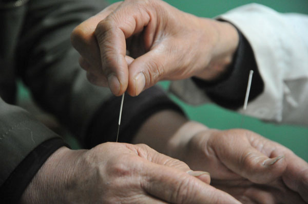 Acupuncture, a significant part of traditional Chinese medicine, has been widely used to treat a range of conditions in the country's TCM hospitals. (Photo provided to China Daily)