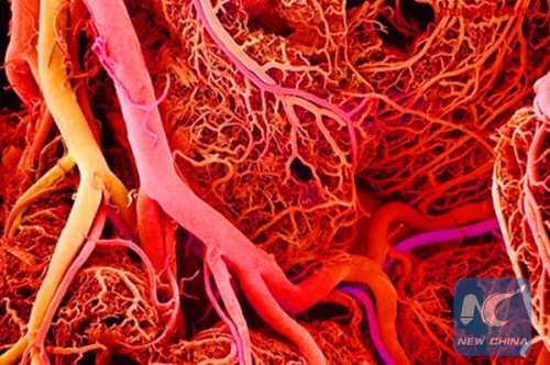 (Blood vessels now can be 3D-printed.Web Photo)