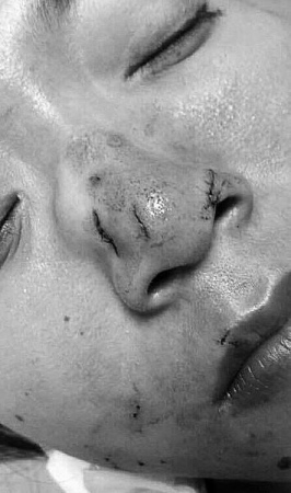 A woman travelling with a group from Shanghai is bitten on her nose by a snake after trying to kiss it in a Thailand shop. (Photo/Screenshot from video)