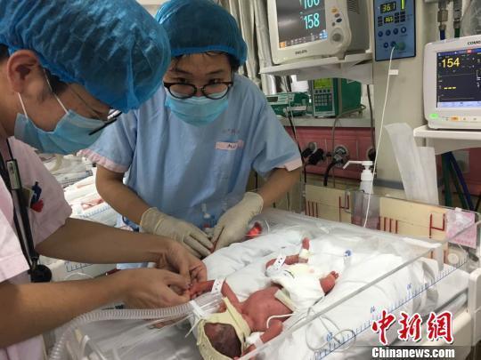 A quadruplet is under intensive care in Shanghai. [Photo/chinanews.com]
