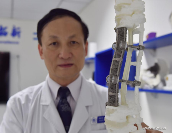 Liu Zhongjun, a surgeon of Peking University Third Hospital, displays a 19-centimeter 3D-printed spinal replica in Beijing, capital of China, July 19, 2016. (Xinhua/Li Wen)