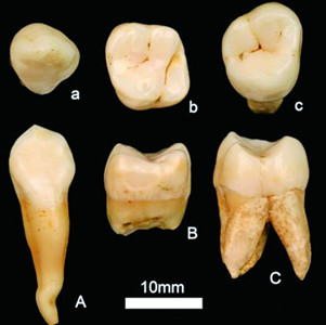 Photo shows tooth fossils found in Bijie, Southwest China's Guizhou Province.
