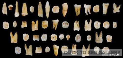 Photo provided by the Institute of Vertebrate Paleontology and Paleoanthropology under the Chinese Academy of Sciences shows tooth fossils found in Daoxian county in central China's Hunan Province. These tooth fossils indicate the early form of modern homo sapiens appeared in the region more than 80,000 years ago. The 47 fossils, found in Daoxian county, date back from 80,000 to 120,000 years and are believed to be the oldest remains of a completely modern form scientists have known in the east Asia region, the study's leading scientists said on Oct. 15, 2015. (Photo/Xinhua) Photo provided by the Institute of Vertebrate Paleontology and Paleoanthropology under the Chinese Academy of Sciences shows tooth fossils found in Daoxian county in central China's Hunan Province. These tooth fossils indicate the early form of modern homo sapiens appeared in the region more than 80,000 years ago. The 47 fossils, found in Daoxian county, date back from 80,000 to 120,000 years and are believed to be the oldest remains of a completely modern form scientists have known in the east Asia region, the study's leading scientists said on Oct. 15, 2015. (Photo/Xinhua)