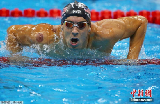 Michael Phelps of the U.S. is seen with red cupping marks on his shoulder and back as he competes in the men's 4 x 100m freestyle relay final at the 2016 Rio Olympics in Rio de Janeiro, Brazil, Aug. 7, 2016. (Photo/Agencies)