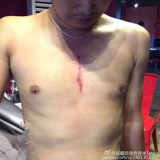 The scar-shaped tattoo. (Photo from Sina Weibo)
