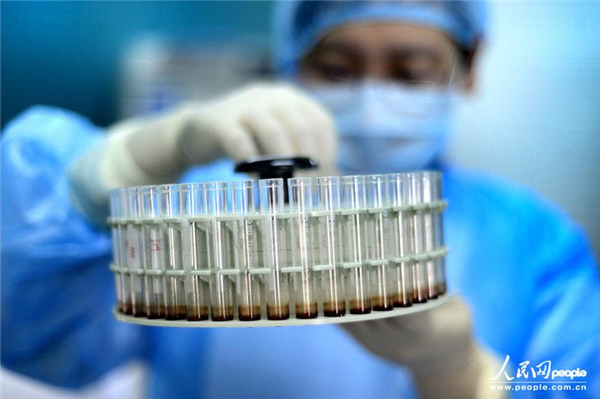 An illustration of lab experiment.(Photo/people.com.cn)