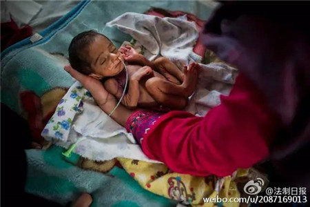 Jiang and her colleague assist in some 1,300 deliveries per month in the 60-bed hospital, five to six times more than that in one Grade 3A hospital in Beijing. Jiang describes her experience as working in an "assembly line". (Photo/Sina Weibo)