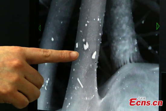 Professor Liu Yong from Beijing University of Chemical Technology shows the smog particles on used masks through an electron microscope on Jan 3, 2017.(Photo: China News Service/Han Haidan)
