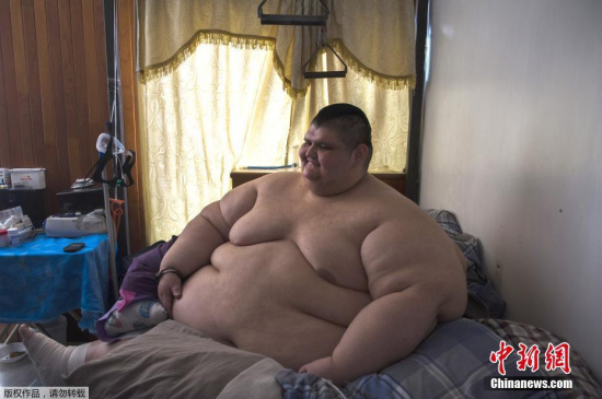 Juan Pedro Franco once weighed more than half a ton at 595 kilos.