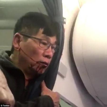 A video screengrab shows passenger David Dao being dragged off a United Airlines flight.