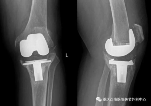 The X film before operation. [Photo: WeChat]