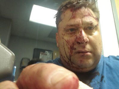 A photo of Luka's bloody face full of bruises on Facebook.