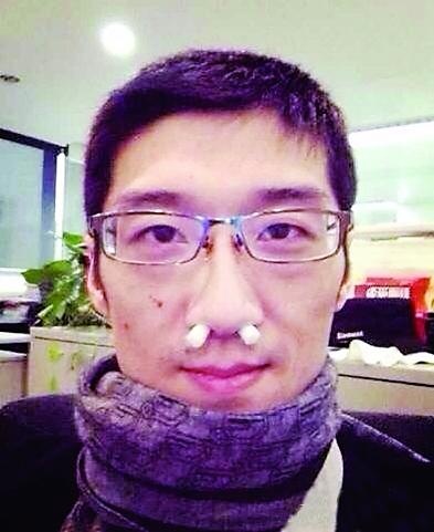 Nose plugs made with cigarette filters.