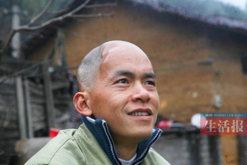 Photo of Wei Liqin, a man with half-skull who lives in a village of Guangxi Zhuang autonomous region. (Photo source: Modern Life Daily)