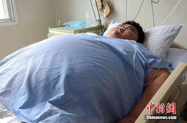 Sun Liang, a 22-year-old, 300-kilogram mentally handicapped man in Shandong province has been suffering from diseases caused by obesity and is in urgent need of financial help from the public. (Photo source: chinanews.com)