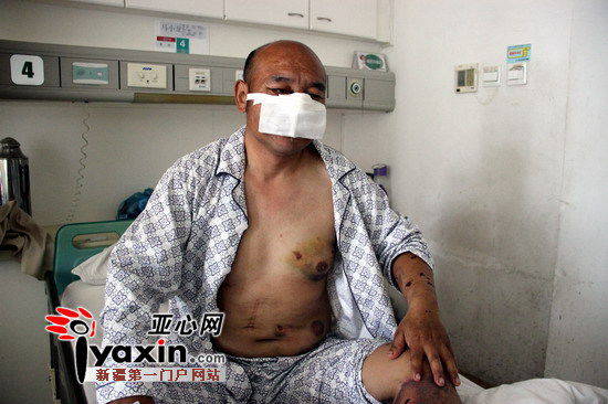 Ma Xiaolong, a man in Xinjiang has made a narrow escape from a brown bear after fighting it off for several minutes. (Photo source: iyaxin.com)