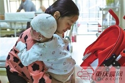 An 18-month-old baby is seriously burned in a fire set by his 3-year-old brother in Linshui County, southwest China��s Sichuan Province. (Photo/CQCB.com)
