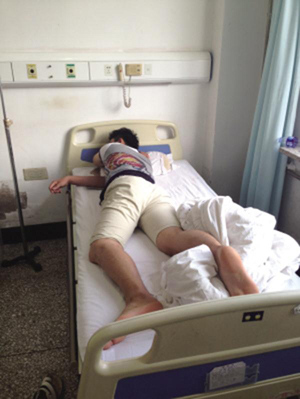 A man surnamed Wang lies in bed after getting mistaken haemorrhoid surgery at Hunnan Hospital in Shenyang City, Liaoning Province. (Photo/Huashang Morning Post)