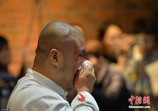 Tai chi master Wei Lei was beaten till bloody in the fighting with mixed martial arts (MMA) fighter Xu Xiaodong (not in the picture) in Chengdu City, Sichuan Province. (Photo/VCG)