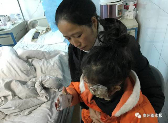 Feng Lingling and her daughter who was burnt in a Samsung Galaxy Note 4 explosion. (Photo/WeChat account of Guizhou Metropolitan Daily)