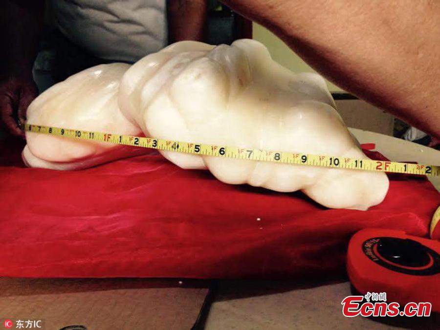 Fisherman kept possibly world's largest pearl for 10 years under his bed(2/2)