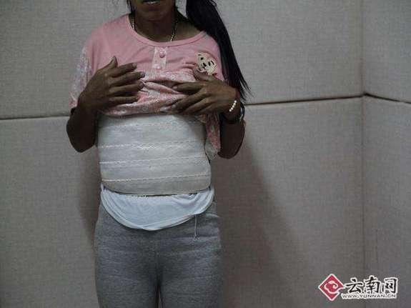A pregnant woman is detained for transporting drugs wrapped on her body in Jinggu County, Pu’er City, Southwest China’s Yunnan Province, Feb. 28, 2017. After receiving a tip-off, local police arrested two pregnant women who had more than 3kg of methamphetamines in a car. (Photo/Yunnan.cn)
