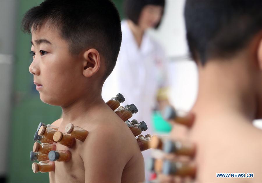 File photo taken on June 21, 2014 shows a boy experiencing cupping treatment at Kangyide Hospital in Beijing, capital of China. Traditional Chinese medicine (TCM), one of the world\'s oldest forms of medicine with different practices including acupuncture, bee-sting therapy, cupping, moxibustion, scrapping, tui na (Chinese therapeutic massage), still prevails in the modern society after thousands of years of evolution, during which generations have restored and maintained health depending on it. The World Health Organization disease index was updated to include references to traditional Chinese medicine for the first time in June 2018. (Photo/Xinhua)