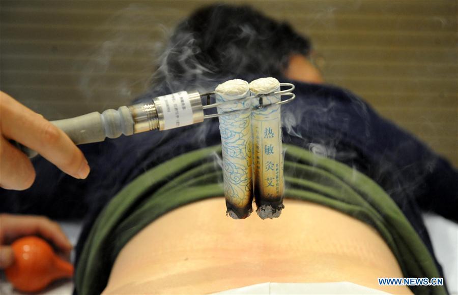 <?php echo strip_tags(addslashes(File photo taken on Sept. 29, 2010 shows a tourist experiencing moxibustion treatment at the Expo Park in Shanghai, east China. Traditional Chinese medicine (TCM), one of the world's oldest forms of medicine with different practices including acupuncture, bee-sting therapy, cupping, moxibustion, scrapping, tuinaing, tui na (Chinese therapeutic massage), still prevails in the modern society after thousands of years of evolution, during which generations have restored and maintained health depending on it. The World Health Organization disease index was updated to include references to traditional Chinese medicine for the first time in June 2018. (Photo/Xinhua))) ?>