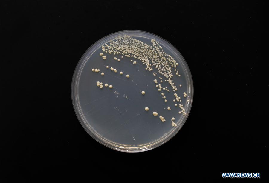 Photo taken on July 31, 2018 shows single chromosome yeast strain at the Center for Excellence in Molecular Plant Sciences, Shanghai Institute of Plant Physiology and Ecology, of Chinese Academy of Sciences in Shanghai, east China. Brewer\'s yeast, one-third of whose genome is said to share ancestry with a human\'s, has 16 chromosomes. However, Chinese scientists have managed to fit nearly all its genetic material into just one chromosome while not affecting the majority of its functions, according to a paper released Thursday on Nature\'s website. Qin Zhongjun, a molecular biologist, and his team used CRISPR-Cas9 genome-editing to create a single chromosome yeast strain, the paper said. (Xinhua/Ding Ting)