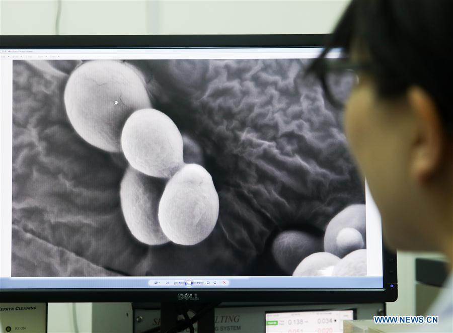 A team member of molecular biologist Qin Zhongjun watches a single chromosome yeast strain through electron microscope at the Center for Excellence in Molecular Plant Sciences, Shanghai Institute of Plant Physiology and Ecology, of Chinese Academy of Sciences in Shanghai, east China, July 31, 2018. Brewer\'s yeast, one-third of whose genome is said to share ancestry with a human\'s, has 16 chromosomes. However, Chinese scientists have managed to fit nearly all its genetic material into just one chromosome while not affecting the majority of its functions, according to a paper released Thursday on Nature\'s website. Qin Zhongjun and his team used CRISPR-Cas9 genome-editing to create a single chromosome yeast strain, the paper said. (Xinhua/Ding Ting)