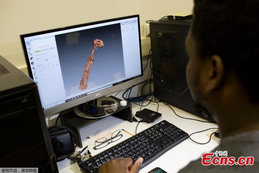 <?php echo strip_tags(addslashes(A 3D scan of the bones of the Egyptian cat mummy is displayed on a computer screen at the Pontifical Catholic University, in Rio de Janeiro, Brazil, Sept. 5, 2018. About 300 pieces of the Brazil's National Museum that were scanned and some printed in 3D could help to rebuild part of the heritage lost in the fire this weekend. Since 2000, researchers at the PUC worked together with the museum, scanning and printing some of the most important objects of the institution. (Photo/Agencies))) ?>